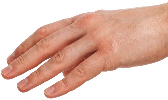Right Hand